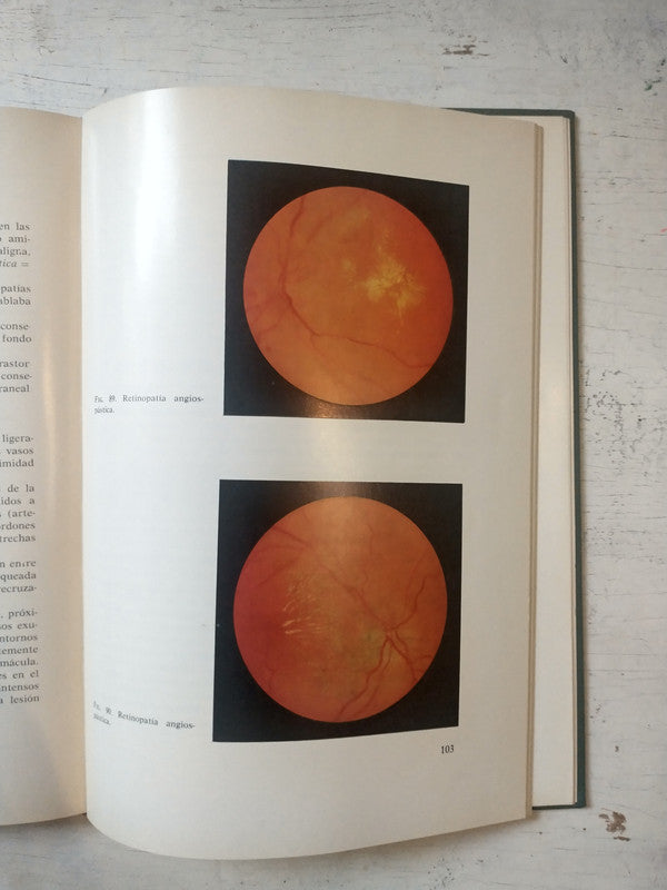Libro usado en venta: Accidente cerebrovascular en la infancia y adolescencia de Gabriel Gonzalez - Hugo A. Arroyo; editorial Journal impreso en 2011.2