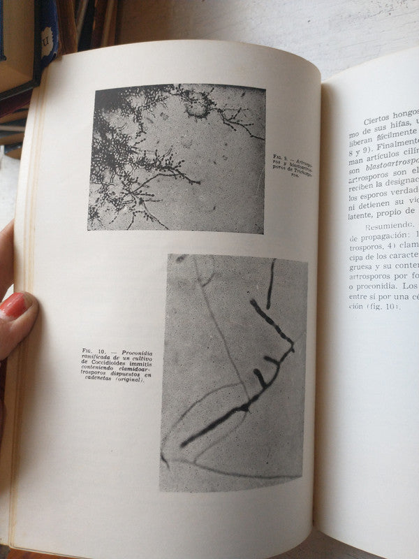 Libro usado en venta: Micosis cutaneas y viscerales de Pablo Negroni; editorial Lopez Libreros impreso en 1988 realizamos envios a todo el mundo.2