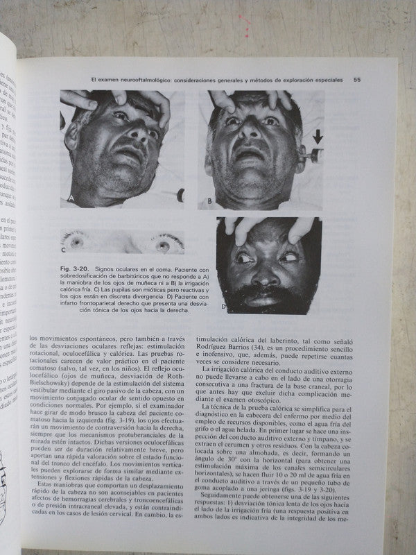 Libro usado en venta: Neurooftalmologia de Joel S. Glaser; editorial Masson - Salvat impreso en 1993 realizamos envios a todo el mundo.3