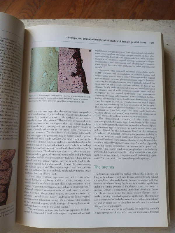 Libro usado en venta: Women's sexual function and dysfunction; editorial Taylor & Francis impreso en 2006 realizamos envios a todo el mundo.4