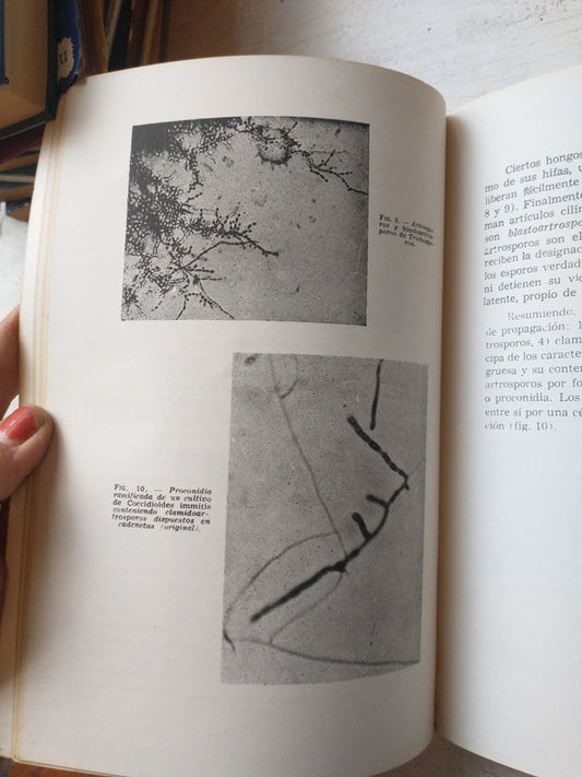 Libro usado en venta: Micosis cutaneas y viscerales de Pablo Negroni; editorial Lopez Libreros impreso en 1988 realizamos envios a todo el mundo.2